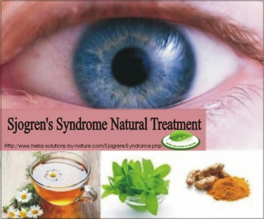 Midodrine and Sjogren's Syndrome: A Potential Solution?